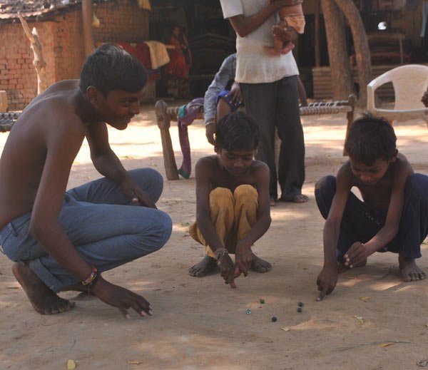Ενα θαύμα της ιατρικής: 18χρονος άντρας που ζει με την καρδιά έξω από το στήθος [εικόνες]  | iefimerida.gr 6