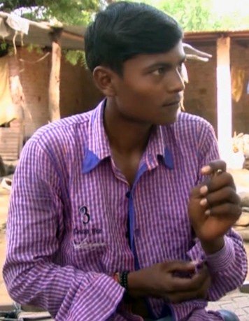 Ενα θαύμα της ιατρικής: 18χρονος άντρας που ζει με την καρδιά έξω από το στήθος [εικόνες]  | iefimerida.gr 0