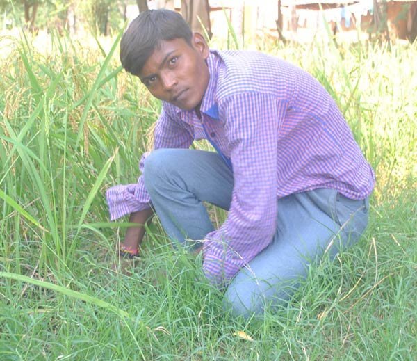 Ενα θαύμα της ιατρικής: 18χρονος άντρας που ζει με την καρδιά έξω από το στήθος [εικόνες]  | iefimerida.gr 7
