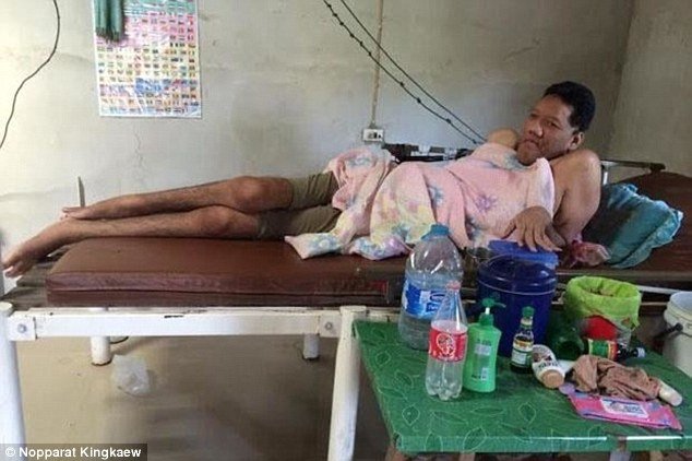 Πέθανε ο πιο ψηλός άνθρωπος στον κόσμο στα 26 του – Είχε ύψος 2.60μ. και πολλά προβλήματα υγείας [εικόνες & βίντεο] | iefimerida.gr 0