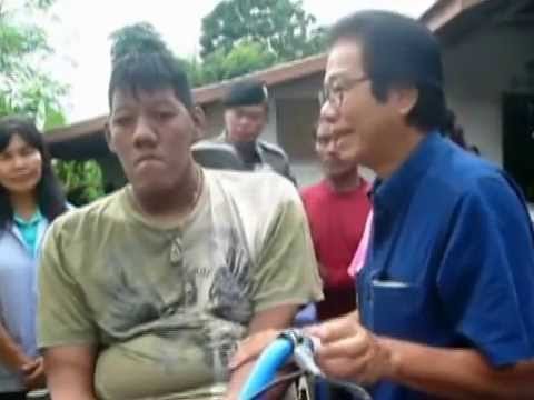 Πέθανε ο πιο ψηλός άνθρωπος στον κόσμο στα 26 του – Είχε ύψος 2.60μ. και πολλά προβλήματα υγείας [εικόνες & βίντεο] | iefimerida.gr 4