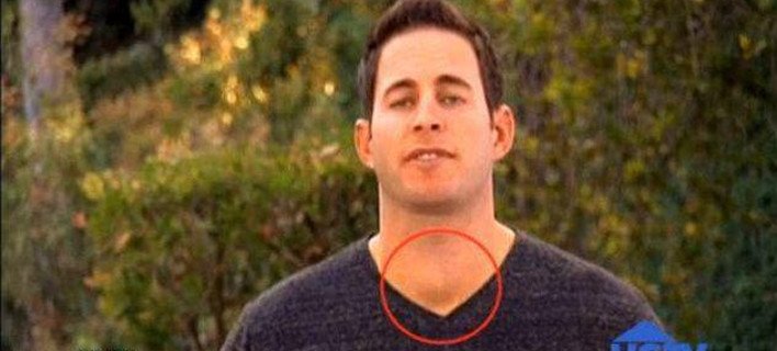 Τον είδε στην τηλεόραση και κατάλαβε ότι πάσχει από ασθένεια στον θυρεοειδή -Μια απίστευτη ιστορία [εικόνες] | iefimerida.gr 2