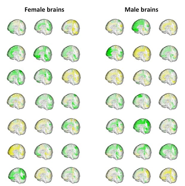 Γιατί δεν υπάρχει ανδρικός και γυναικείος εγκέφαλος -Νέα έρευνα αποκαλύπτει [εικόνα] | iefimerida.gr 0