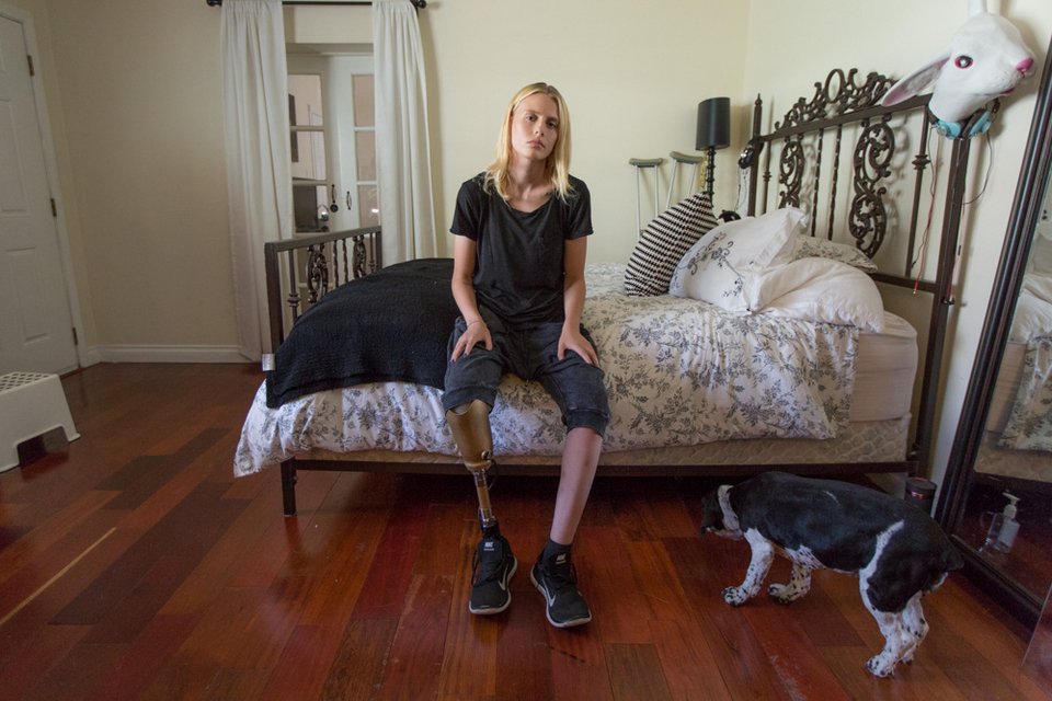 Της έκοψαν το πόδι εξαιτίας ενός ταμπόν -Πώς ζει σήμερα το πανέμορφο μοντέλο [εικόνες] | iefimerida.gr 3