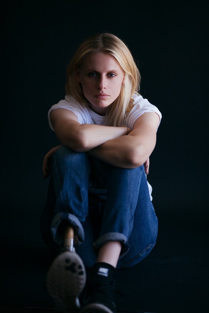 Της έκοψαν το πόδι εξαιτίας ενός ταμπόν -Πώς ζει σήμερα το πανέμορφο μοντέλο [εικόνες] | iefimerida.gr 8