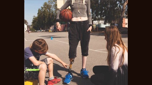 Της έκοψαν το πόδι εξαιτίας ενός ταμπόν -Πώς ζει σήμερα το πανέμορφο μοντέλο [εικόνες] | iefimerida.gr 11
