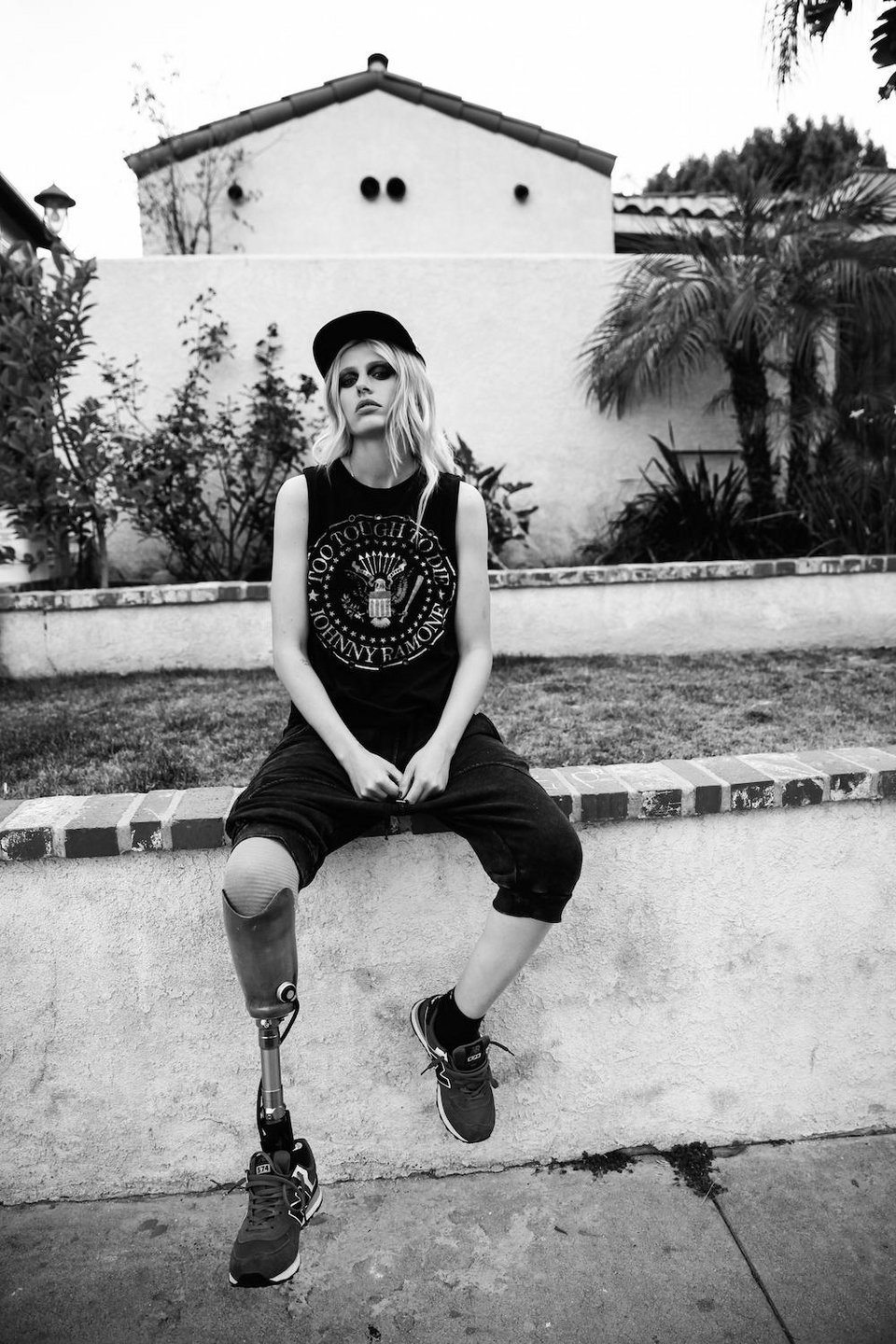 Της έκοψαν το πόδι εξαιτίας ενός ταμπόν -Πώς ζει σήμερα το πανέμορφο μοντέλο [εικόνες] | iefimerida.gr 0