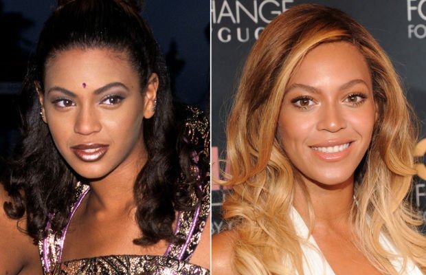 Πριν & μετά τον πλαστικό: 10 σούπερ σταρ & ο... Πούτιν! [εικόνες] | iefimerida.gr 2