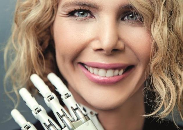 Ειρήνη Οικονόμου: Η πρώτη γυναίκα στην Ελλάδα με βιονικό χέρι [εικόνες] | iefimerida.gr 2