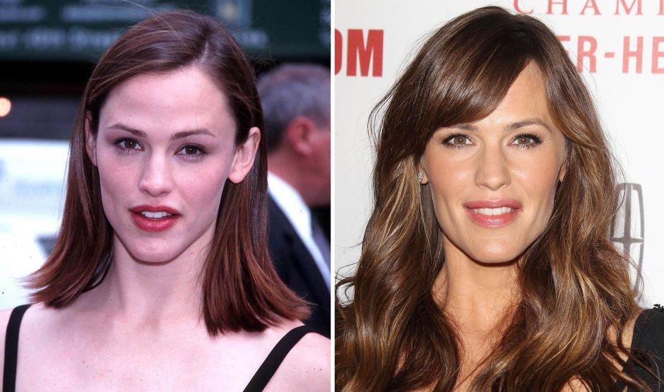 Πριν & μετά τον πλαστικό: 10 σούπερ σταρ & ο... Πούτιν! [εικόνες] | iefimerida.gr 5