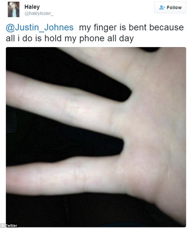 Ποστάρουν φωτογραφίες με τα παραμορφωμένα τους δάχτυλα -Από την ατελείωτη χρήση smart phones [εικόνες] | iefimerida.gr 1