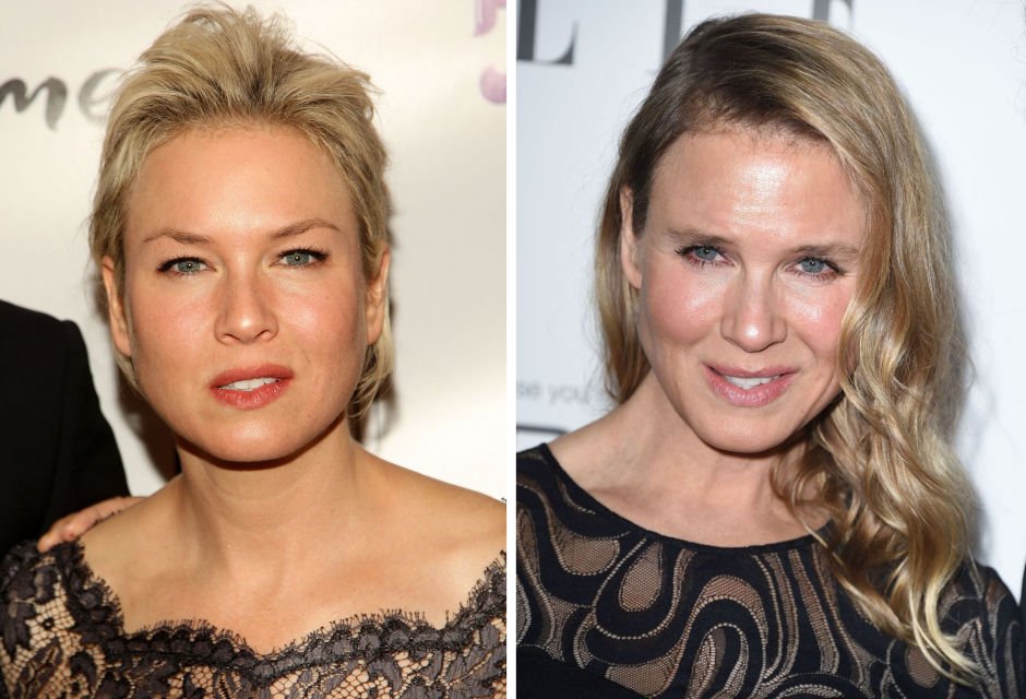 Πριν & μετά τον πλαστικό: 10 σούπερ σταρ & ο... Πούτιν! [εικόνες] | iefimerida.gr 0