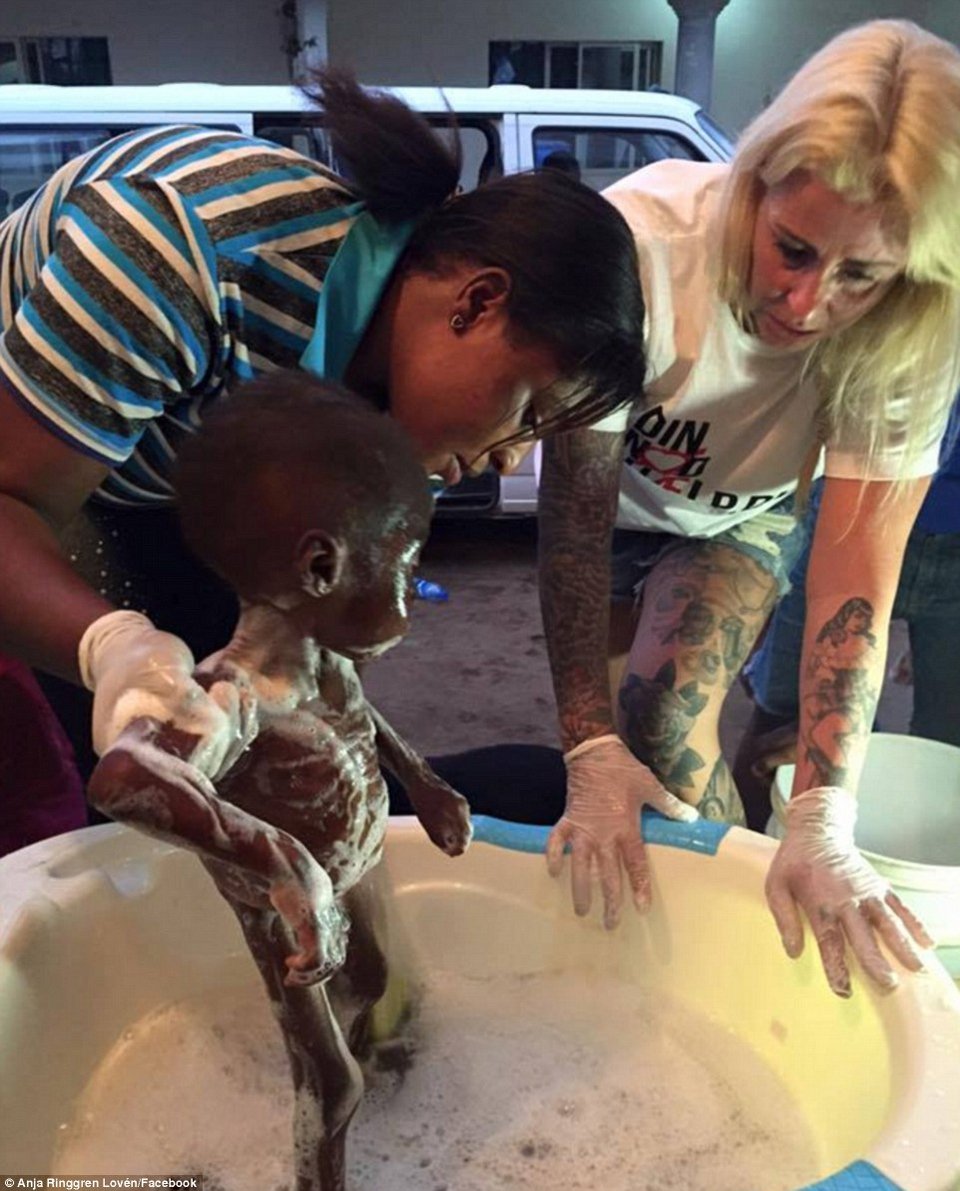 Φωτογραφίες σοκ: Αφησαν 2χρονο αγόρι να αποστεωθεί γιατί πίστευαν ότι ήταν μάγος [εικόνες] | iefimerida.gr 3