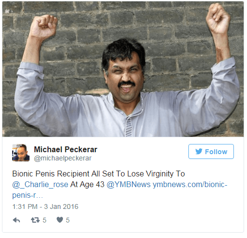 Ο άντρας με το βιονικό πέος έχασε την παρθενιά του [εικόνες] | iefimerida.gr 1