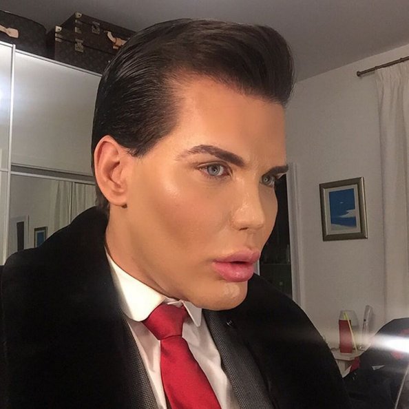 Ο άνδρας που μοιάζει με τον «Κεν» της Μπάρμπι -Εχει ξοδέψει 386.000 ευρώ σε 42 επεμβάσεις [εικόνες] | iefimerida.gr 10