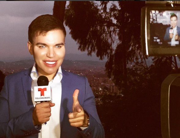 Ο άνδρας που μοιάζει με τον «Κεν» της Μπάρμπι -Εχει ξοδέψει 386.000 ευρώ σε 42 επεμβάσεις [εικόνες] | iefimerida.gr 12