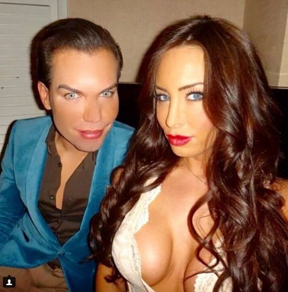 Ο άνδρας που μοιάζει με τον «Κεν» της Μπάρμπι -Εχει ξοδέψει 386.000 ευρώ σε 42 επεμβάσεις [εικόνες] | iefimerida.gr 14