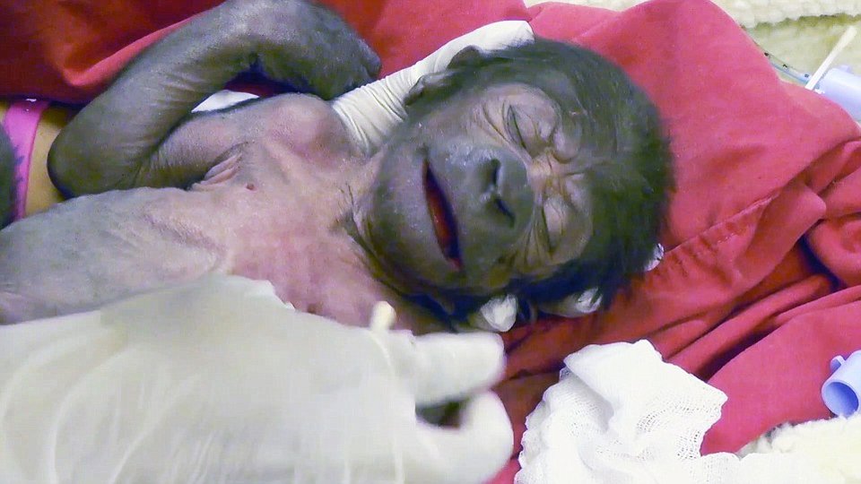 Το γοριλάκι που έγινε viral -Ηρθε στον κόσμο με καισαρική [εικόνες] | iefimerida.gr 6