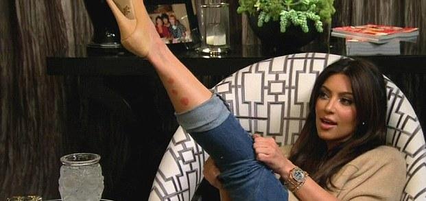 Νέο αποτελεσματικό χάπι για την ψωρίαση είναι πλέον διαθέσιμο και στην Ελλάδα - Σταρ με το πρόβλημα [εικόνες] | iefimerida.gr 4