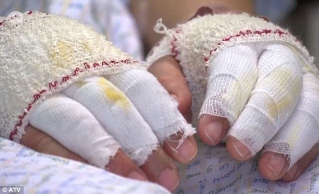 «Η έκρηξη έμοιαζε με το τέλος του κόσμου» -20χρονη τραυματίας περιγράφει τι έγινε μετά την επίθεση [εικόνες] | iefimerida.gr 0