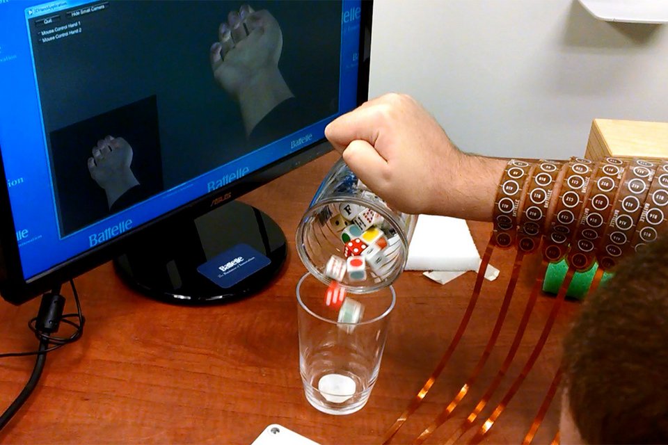 Τσιπάκι επιτρέπει σε έναν τετραπληγικό να κουνά το χέρι του με τις σκέψεις του [εικόνες]  | iefimerida.gr 0