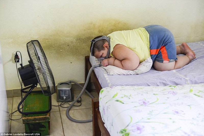 Απίστευτο: Είναι 5 χρονών και ζυγίζει 75 κιλά [εικόνες & βίντεο] | iefimerida.gr 4