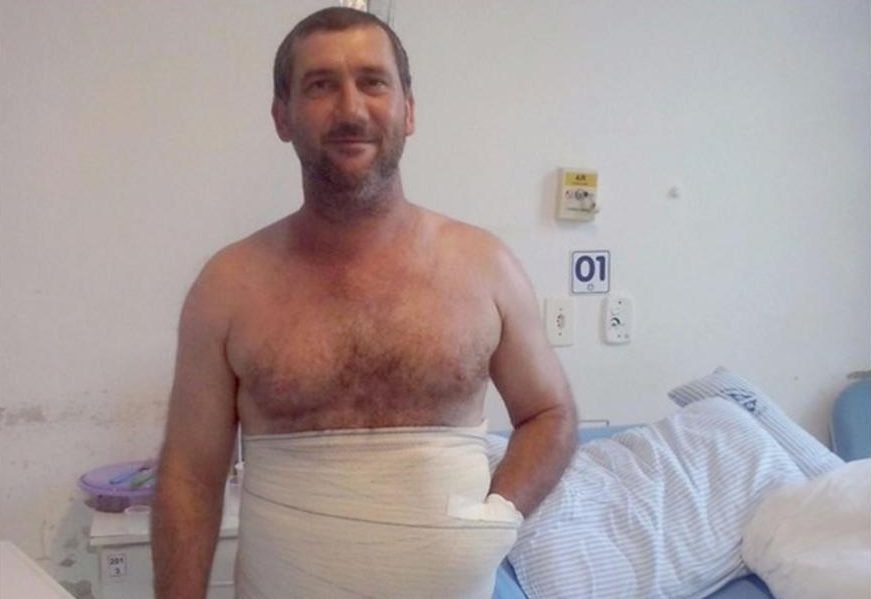 Χειρουργός έραψε το χέρι ασθενούς στο στομάχι του για να το σώσει [εικόνα] | iefimerida.gr 0