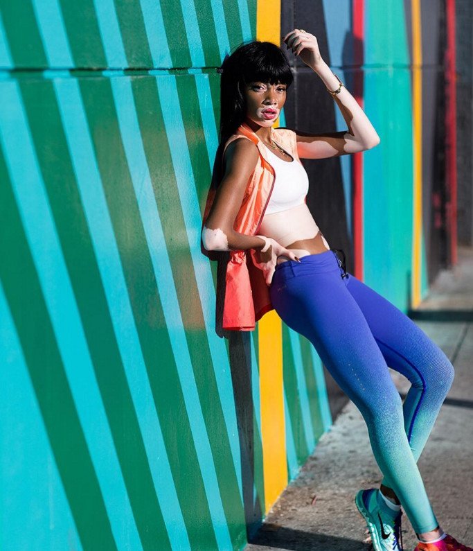 Το μοντέλο με τη λεύκη που «σβήνει» όλα τα τοπ μόντελ [εικόνες] | iefimerida.gr 20