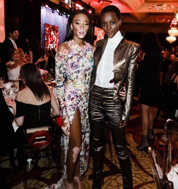 Το μοντέλο με τη λεύκη που «σβήνει» όλα τα τοπ μόντελ [εικόνες] | iefimerida.gr 15