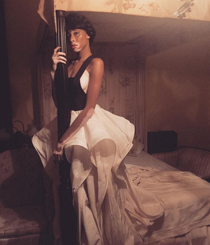 Το μοντέλο με τη λεύκη που «σβήνει» όλα τα τοπ μόντελ [εικόνες] | iefimerida.gr 17