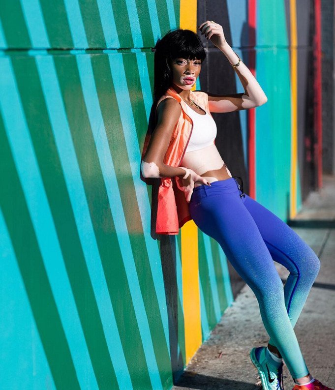 Το μοντέλο με τη λεύκη που «σβήνει» όλα τα τοπ μόντελ [εικόνες] | iefimerida.gr 11