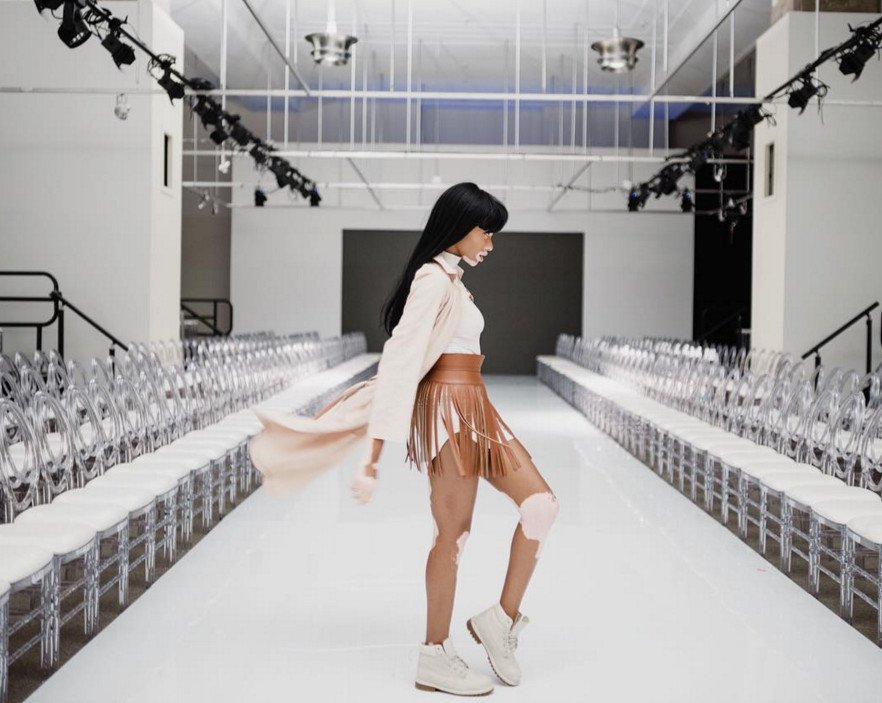 Το μοντέλο με τη λεύκη που «σβήνει» όλα τα τοπ μόντελ [εικόνες] | iefimerida.gr 7