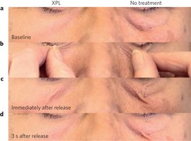 Το νέο lifting των 24 ωρών: Εξαφανίζει τις ρυτίδες [εικόνες] | iefimerida.gr 2
