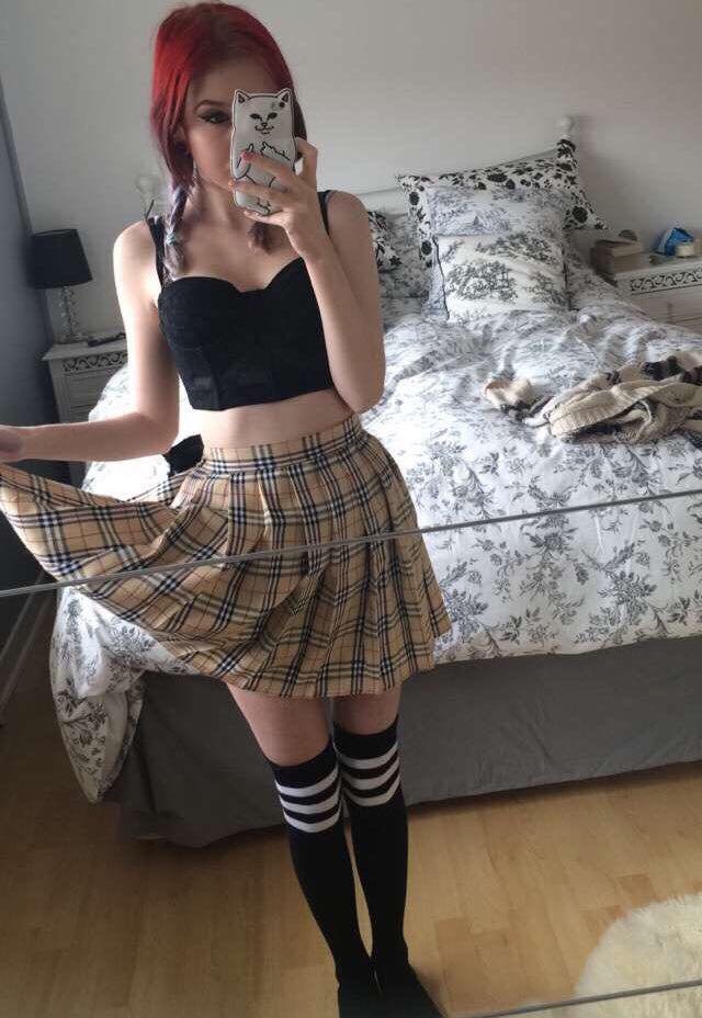 19χρονη φωτογραφίζεται με τη νόσο του Κρον και συγκλονίζει το Ιντερνετ [εικόνες] | iefimerida.gr 2