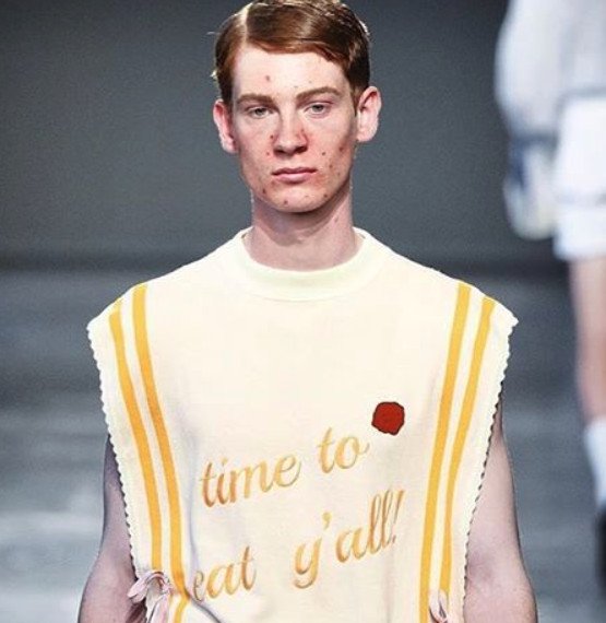 Μοντέλα με ακμή σε πασαρέλες του Μιλάνο [εικόνες] | iefimerida.gr 3