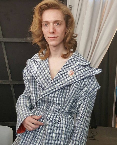 Μοντέλα με ακμή σε πασαρέλες του Μιλάνο [εικόνες] | iefimerida.gr 4