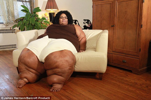 Η γυναίκα με τα μεγαλύτερα (σε πλάτος) πόδια [εικόνες] | iefimerida.gr 0