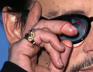 Φωτογραφία σοκ: Ο Τζόνι Ντεπ τσαντίστηκε με την Αμπερ Χερντ και έκοψε το δάχτυλό του [εικόνες] | iefimerida.gr 4