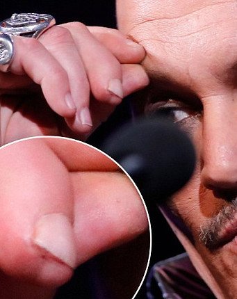 Φωτογραφία σοκ: Ο Τζόνι Ντεπ τσαντίστηκε με την Αμπερ Χερντ και έκοψε το δάχτυλό του [εικόνες] | iefimerida.gr 5