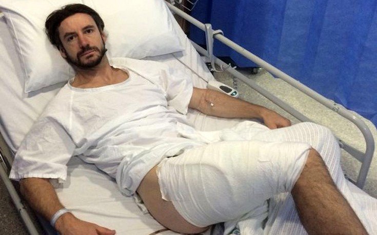Ετσι έγινε το πόδι ενός ποδηλάτη στην Αυστραλία όταν πήρε φωτιά το iPhone του | iefimerida.gr 0