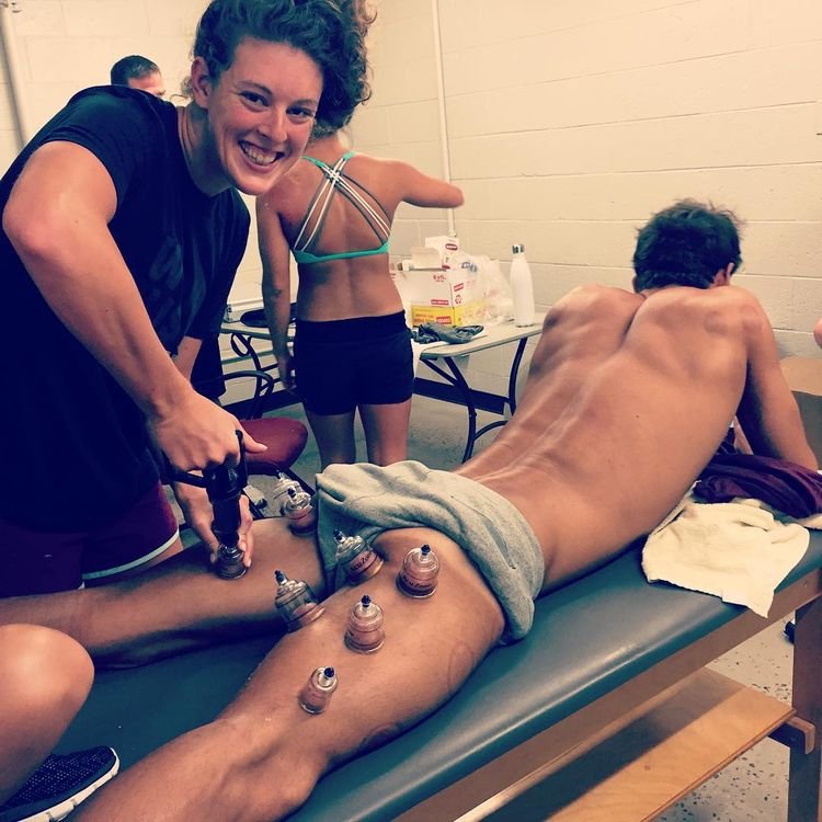 Γιατί οι αθλητές στο Ρίο είναι γεμάτοι μελανές βούλες [εικόνες] | iefimerida.gr 0