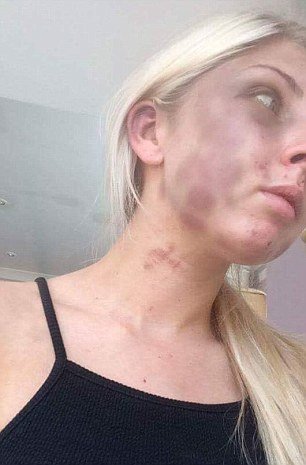 Χτυπούσε για 4 ώρες τη σύντροφό του, επειδή δεν του έφερε τσιγάρα! [εικόνες] | iefimerida.gr 1