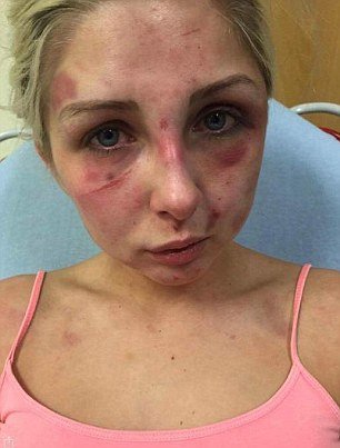 Χτυπούσε για 4 ώρες τη σύντροφό του, επειδή δεν του έφερε τσιγάρα! [εικόνες] | iefimerida.gr 2