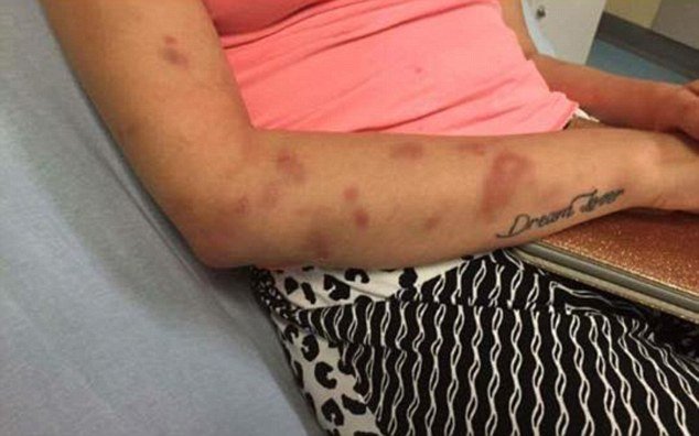 Χτυπούσε για 4 ώρες τη σύντροφό του, επειδή δεν του έφερε τσιγάρα! [εικόνες] | iefimerida.gr 3