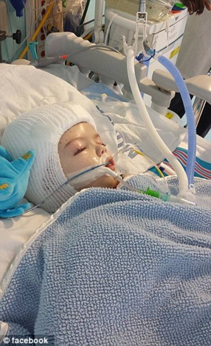 Κατάφεραν να χωρίσουν σιαμαία ενωμένα στο κεφάλι [εικόνες]  | iefimerida.gr 2