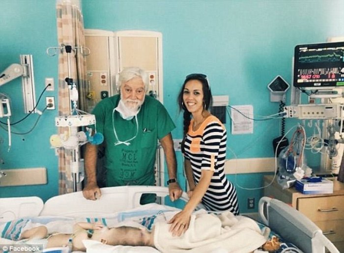 Κατάφεραν να χωρίσουν σιαμαία ενωμένα στο κεφάλι [εικόνες]  | iefimerida.gr 1