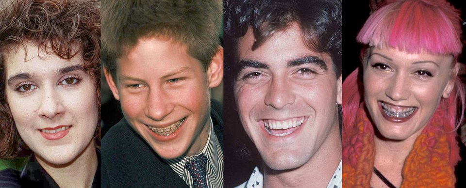 Οταν οι σταρ είχαν σοβαρά προβλήματα με τα δόντια τους [εικόνες] | iefimerida.gr 0