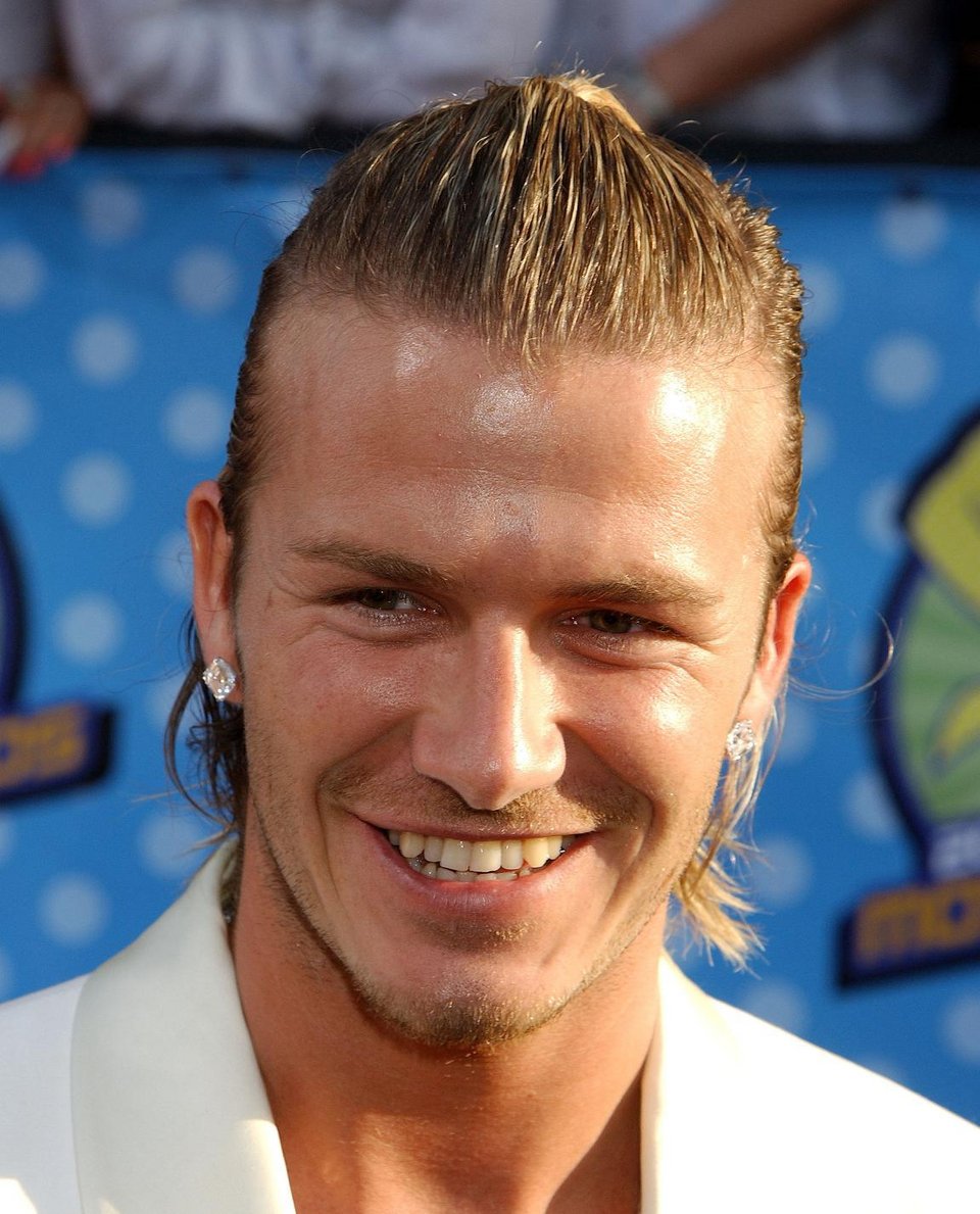 Οταν οι σταρ είχαν σοβαρά προβλήματα με τα δόντια τους [εικόνες] | iefimerida.gr 1