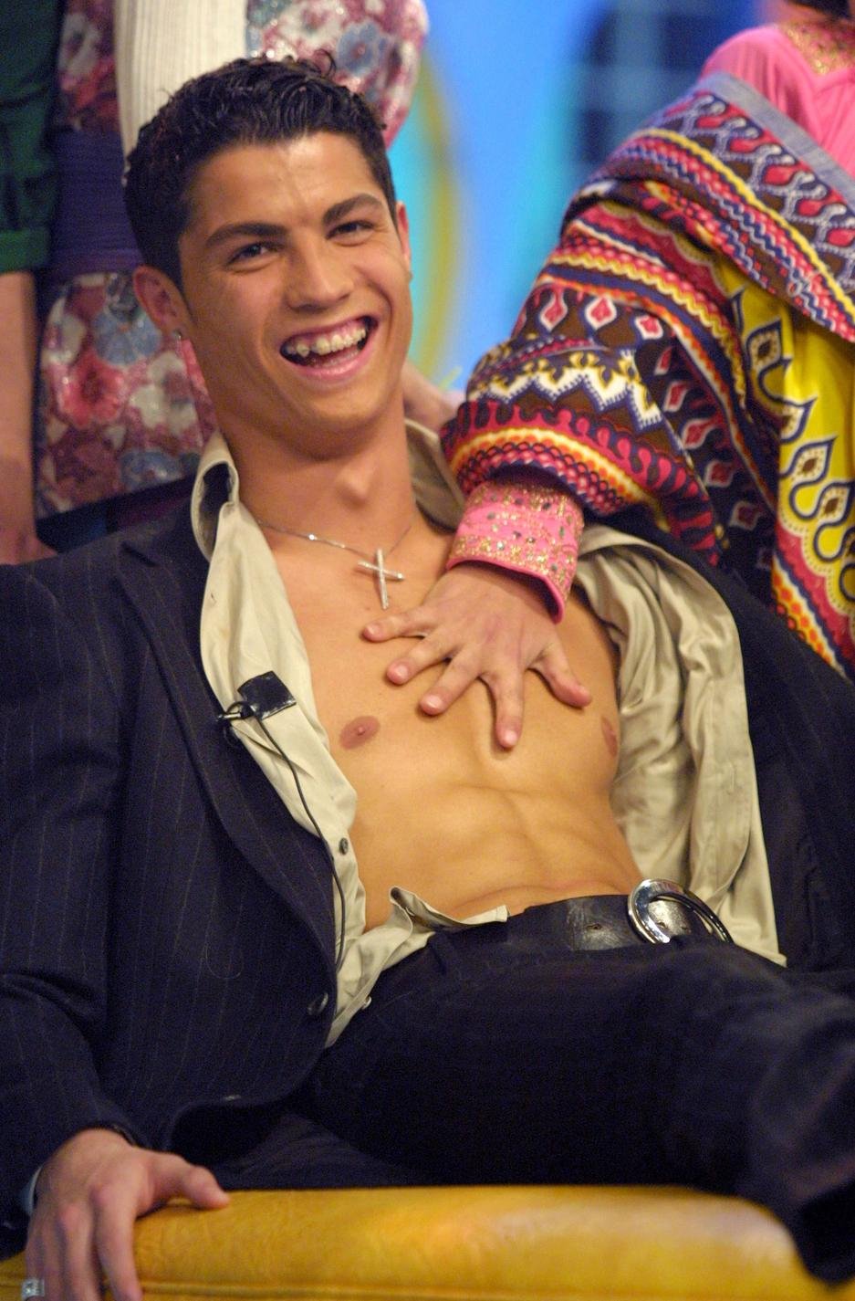 Οταν οι σταρ είχαν σοβαρά προβλήματα με τα δόντια τους [εικόνες] | iefimerida.gr 3