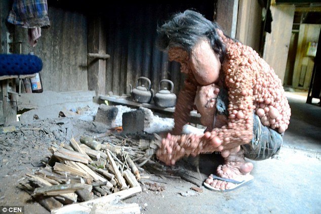 Ο άνδρας που έζησε 45 χρόνια κλεισμένος σπίτι του [εικόνες] | iefimerida.gr 0